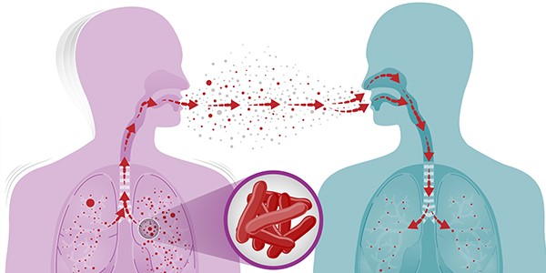 How TB spreads. / Illustration: CDC.