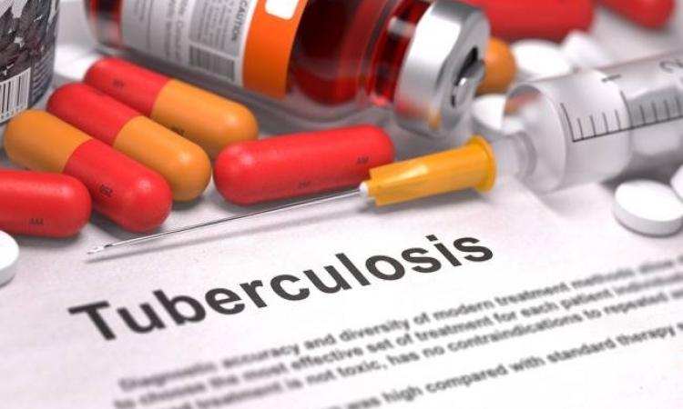 Drug use and injection drug use are essential factors in tuberculosis (TB) epidemiology in developed and developing countries. / Photo: Adobe Stock.
